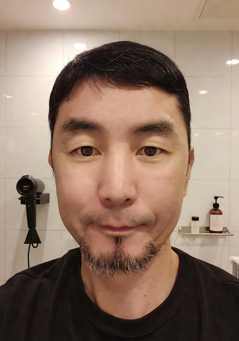 관리 후 얼굴 사진